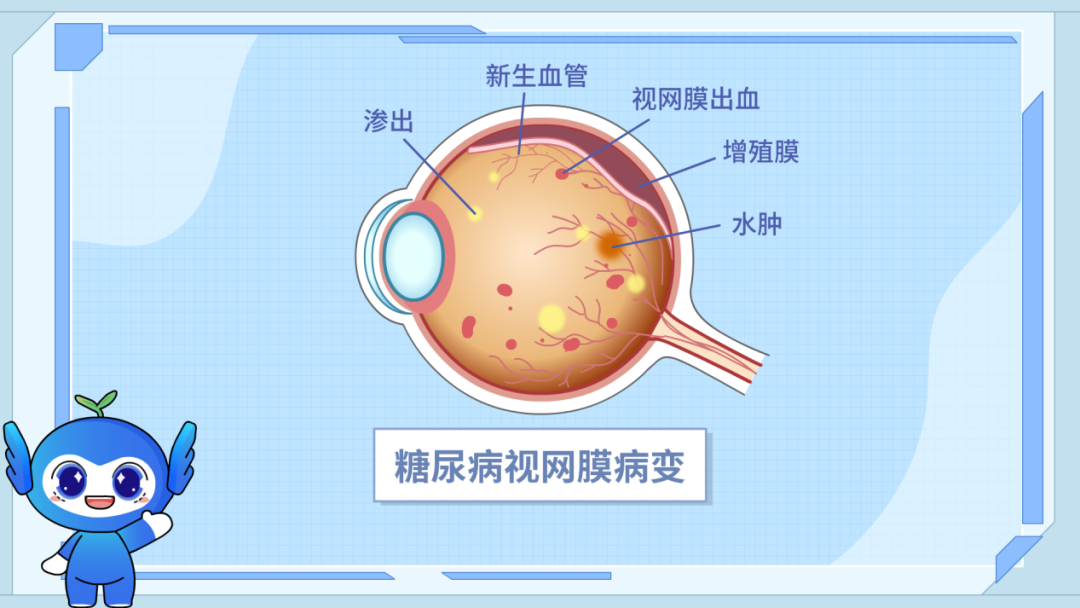奶茶一杯两杯三杯四杯...当心眼睛陷入这个“甜蜜陷阱”！