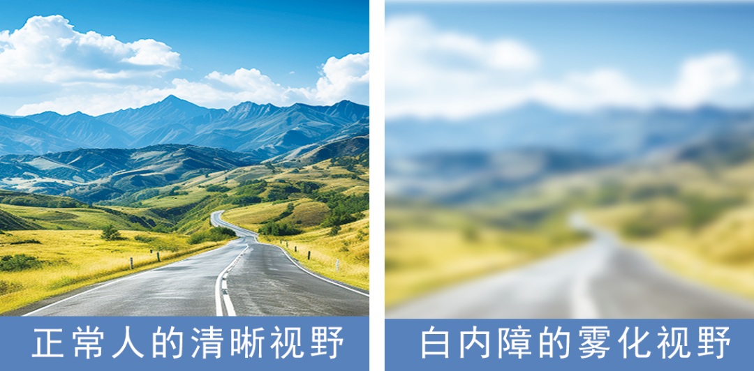 戴不戴眼镜都看不清，这是怎么了？