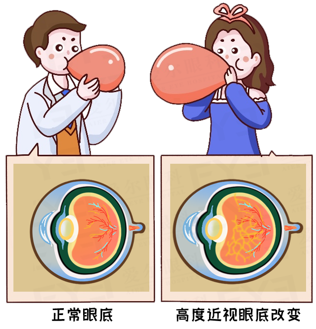 2000度超高度近视，是种什么体验？